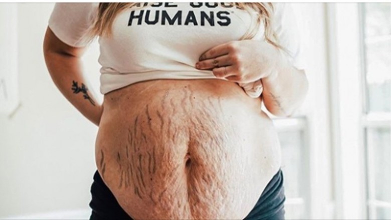 Galeria odważnych kobiet, które nie wstydzą się pokazać swojego ciała po ciąży