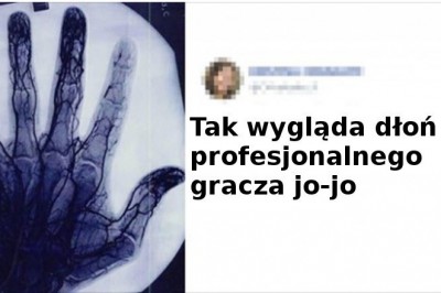 Niezwykłe zdjęcia, których nie znajdzie się nawet w największych encyklopediach