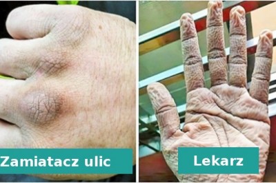 Ci ludzie pokazują jak naprawdę wygląda ich praca oraz jej skutki i rezultaty