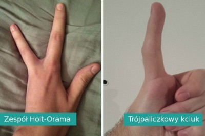 Podzielili się zdjęciami swoich niezwykłych części ciała. Biologia ciągle zaskakuje