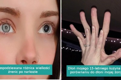 13 nieoczekiwanych zdjęć pokazujących, jak zaskakujące bywa nasze ciało