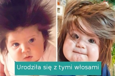 18 osób, które otrzymały niezwykłe dary od natury i zaskakują wyglądem
