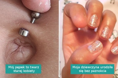 15 przypadków, w których natura ukazała potęgę genów u ludzi i zwierząt