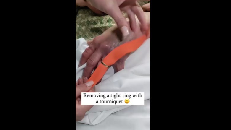 Ciekawy sposób na ściągnięcie obrączki z palca