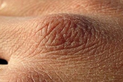 Możesz spożywać zbyt mało płynów. To 8 typowych objawów, że pijesz za mało wody