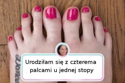 15 niezwykłych osób, które otrzymały nietypowe dary od matki natury