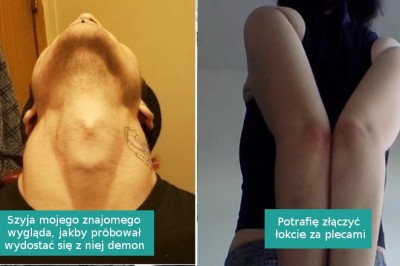 16 osób, których ciała są pełne bardzo nietypowych „skarbów”