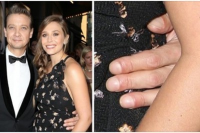 10 gwiazd, których drobne niedoskonałości są niemal niedostrzegalne dla widzów