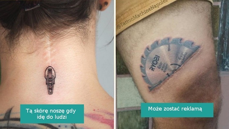Przy pomocy tatuaży i kreatywności zmienili blizny w małe dzieła sztuki