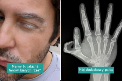 16 osób i zwierząt o niezwykłych cechach wyglądu