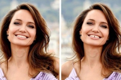 15 fotografii pokazujących jak nieidealne zęby potrafią zmienić twoją twarz