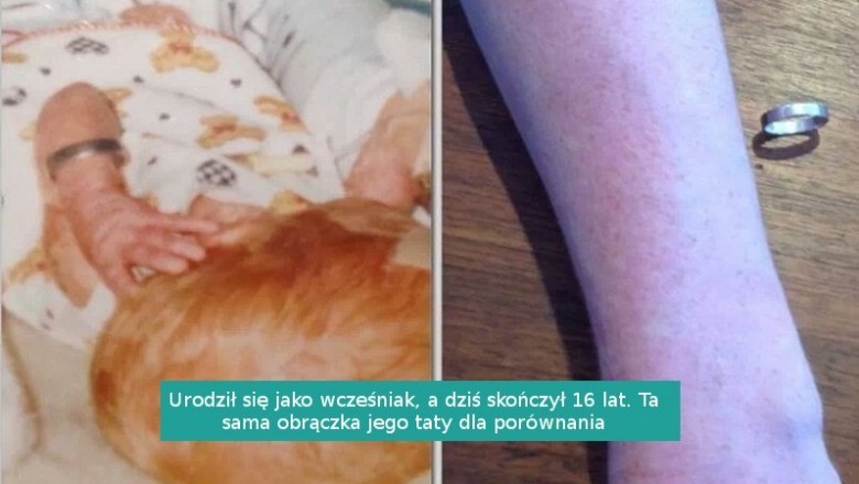 17 fotografii pokazujących nieubłagany upływ czasu i to, jak nas zmienia