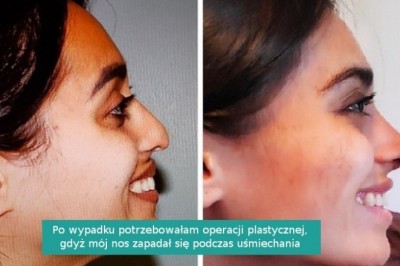 14 osób, które włożyły dużo wysiłku, żeby zmienić się nie do poznania