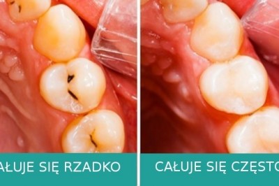 7 zmian, które mogą zajść w twoim ciele w czasie pocałunku