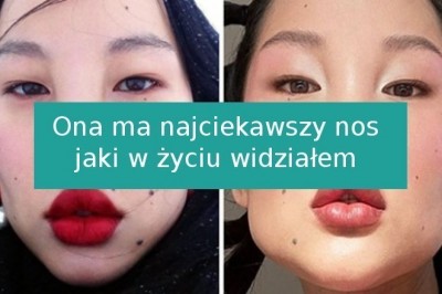 15 unikalnych osób, które urodziły się z niezwykłymi cechami fizycznymi