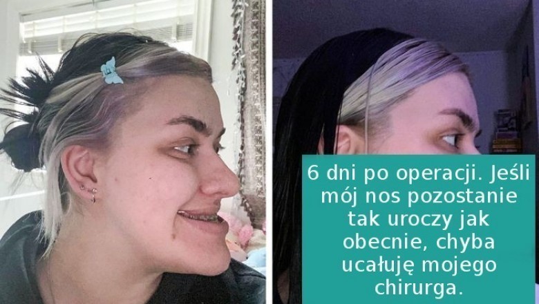 18 osób, które przeszły metamorfozę i odzyskały pewność siebie