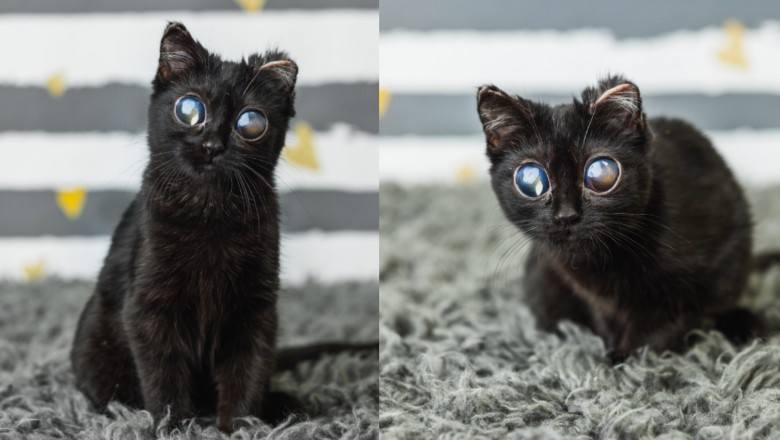 Myśleli, że jej oczy to wytwór AI. Prawda jest niestety o wiele smutniejsza